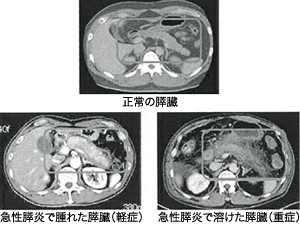 図：膵臓